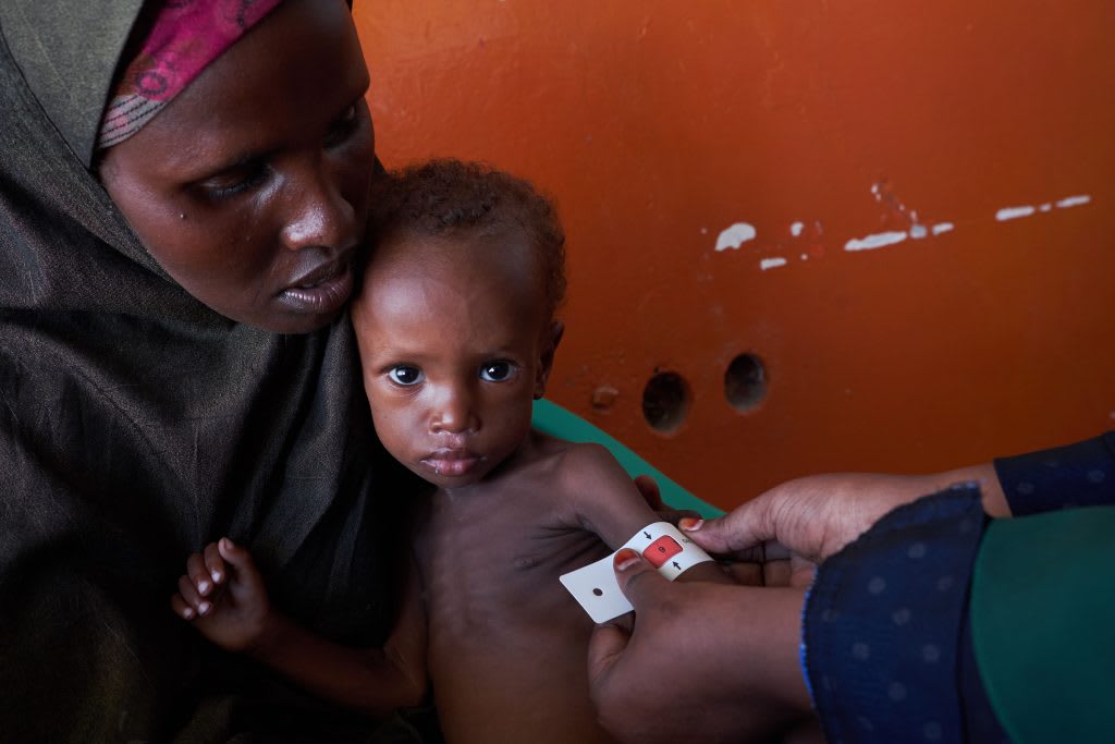 Somalie-ACF-Sous-Nutrition-Khadija-Farrah-1024x683